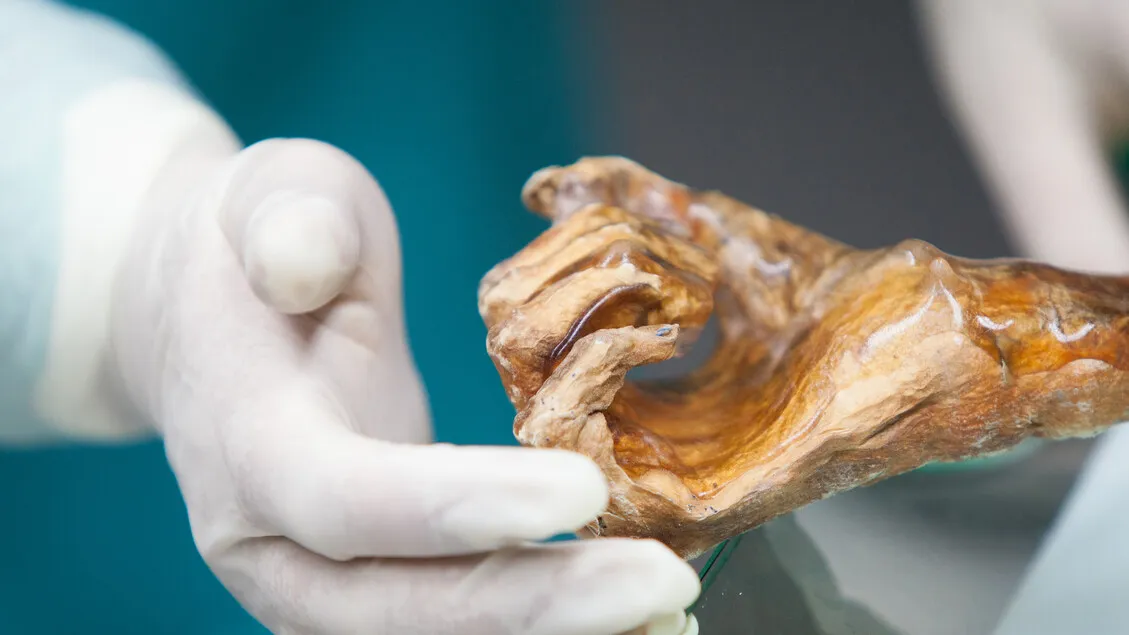 Misteri Mikrobioma Ötzi 5 Milenium Terkuak: Dampak Besar Industri Medis