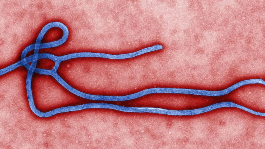 Ancaman Senyap Virus Bundibugyo: Mengapa Dunia Harus Waspada?